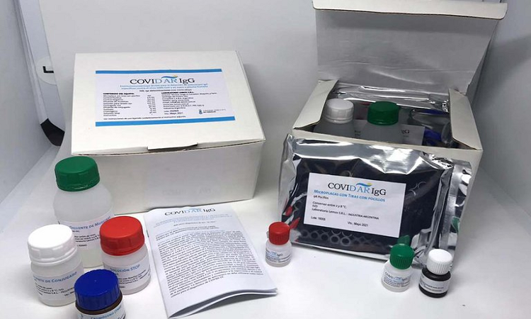 El primer test serológico argentino para COVID-19 se produce en el Instituto Leloir