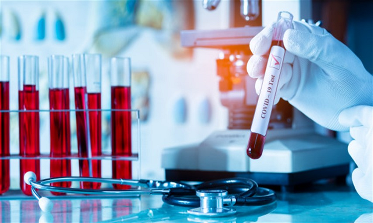 Coronavirus: 1.055 nuevos casos en la provincia 