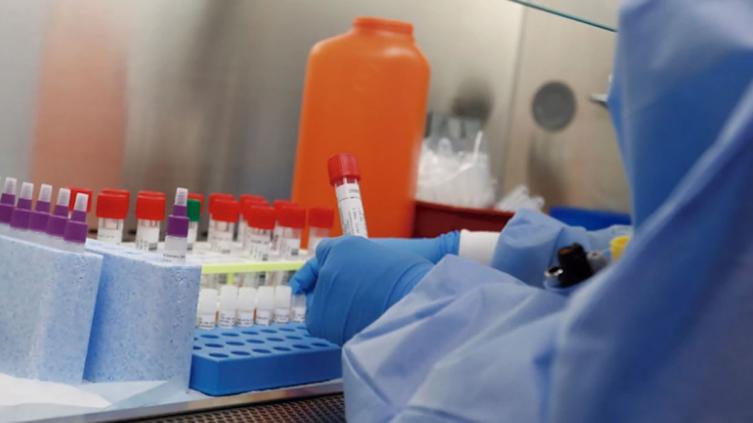 Santa Fe: 1.733 nuevos casos de coronavirus y 24 muertes 
