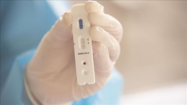 La ANMAT aprobó el test argentino para la detección rápida 