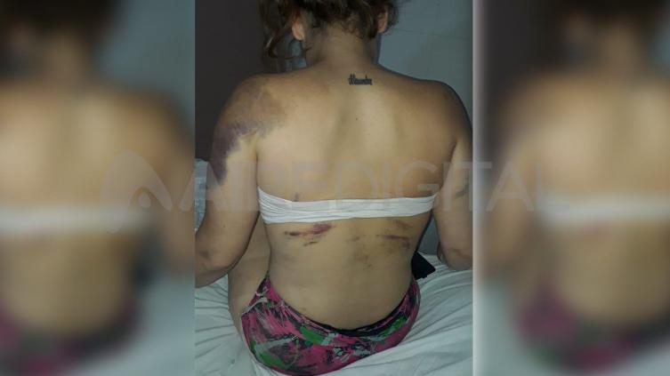Trasladaron al Cullen a la mujer golpeada y secuestrada por su pareja 
