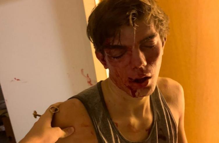 Salvaje robo a dos jovenes en un edificio céntrico