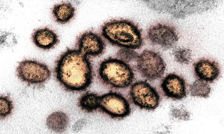 Informe de la ONU advierte sobre 1,7 millones de virus aún no descubiertos