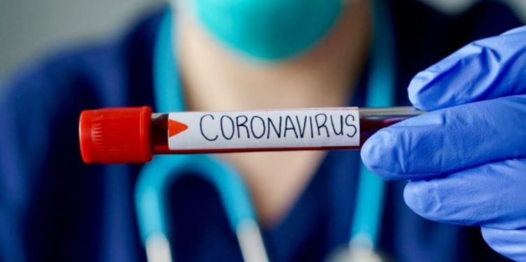 Por qué nunca podremos convivir con el COVID como sucede con la gripe