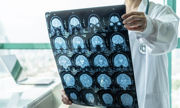 Casco magnético: permite encoger tumores cerebrales