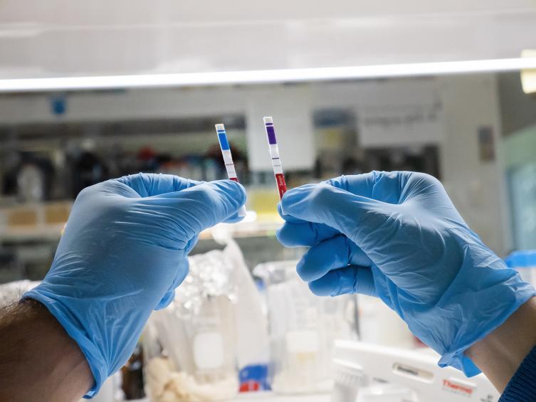 Crearon en el país un test rápido para anticuerpos de coronavirus