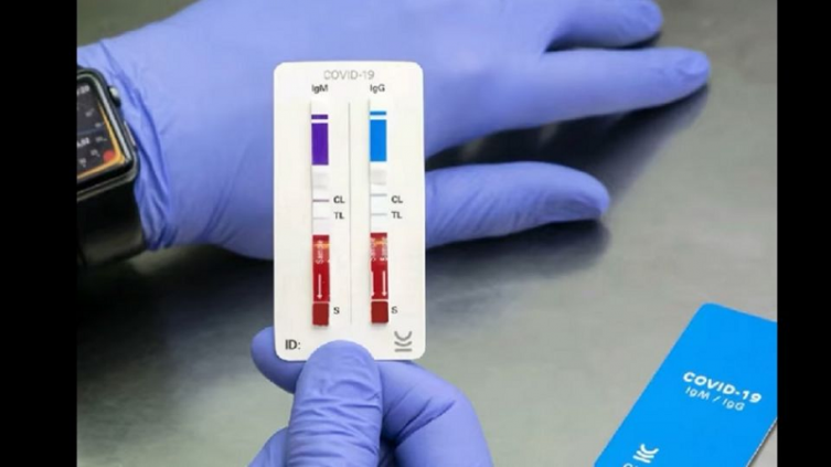 COVID-19: crearon un test rápido con resultados en 10 minutos 
