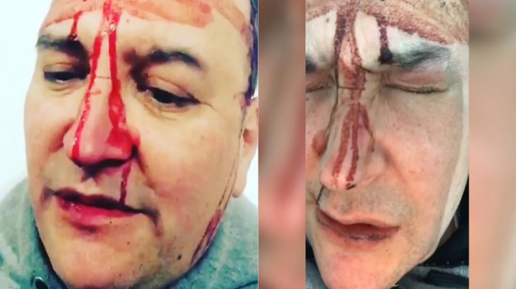 Leo García víctima de un ataque homofóbico
