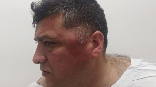 Brutal golpiza al entrenador Arnaldo Quiroga 