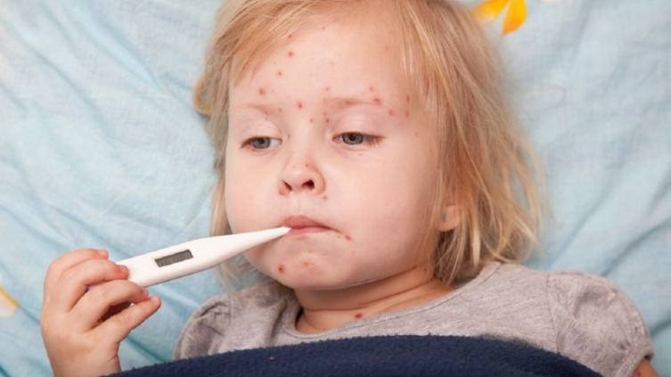 Primavera: época de enfermedades eruptivas en niños