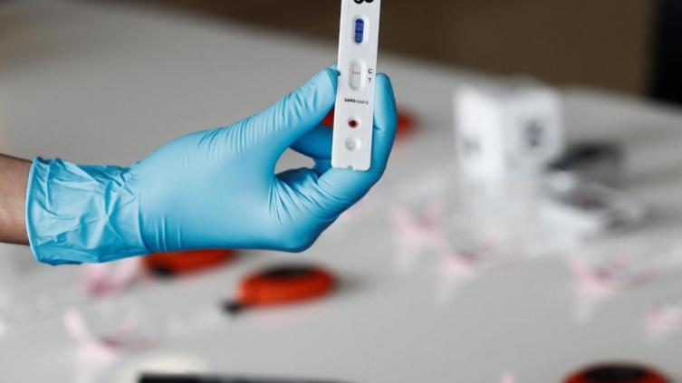 Murieron 12 personas y 2.445 resultaron contagiadas de coronavirus en el país
