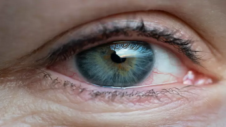Qué es el glaucoma y cómo prevenirlo