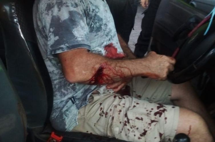 Apuñalaron a un taxista en barrio Nueva Pompeya