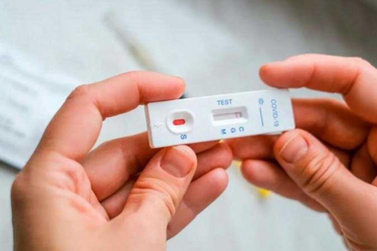 La ANMAT autorizó un nuevo autotest de coronavirus