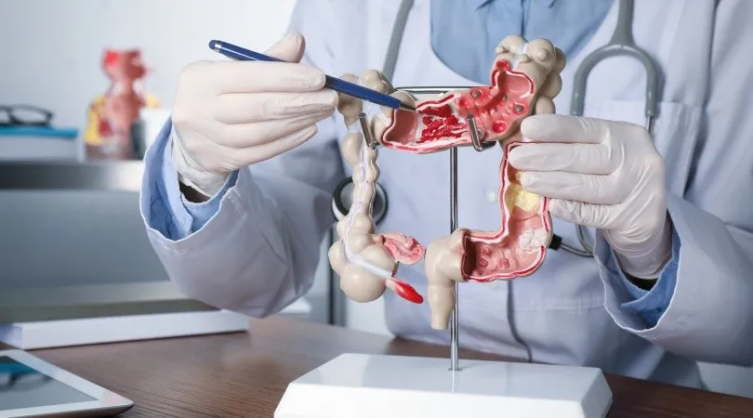 Cáncer Colorrectal: la importancia de la prevención y concientización