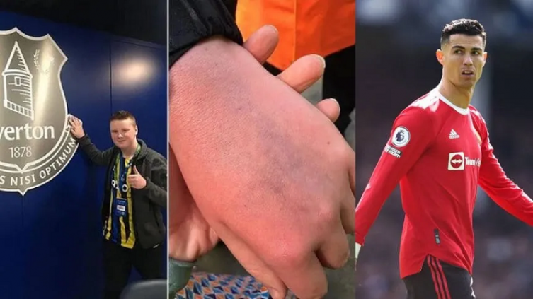 Cristiano Ronaldo agredió a un niño del Everton: habló la madre