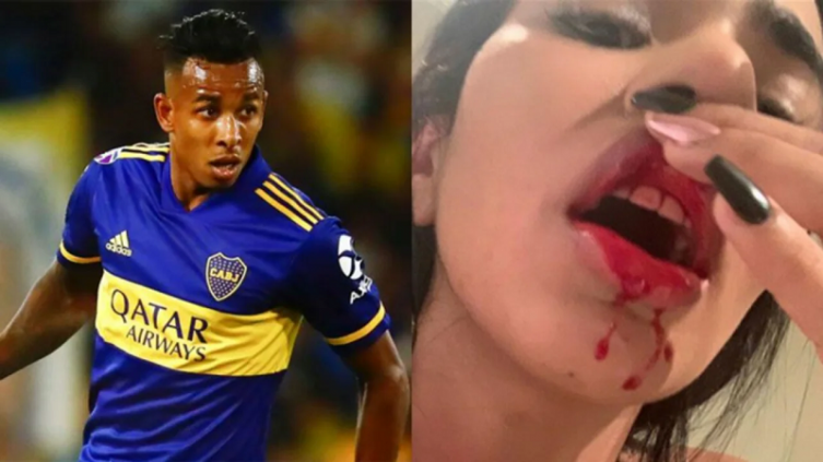 Los casos anteriores de violencia de género en Boca
