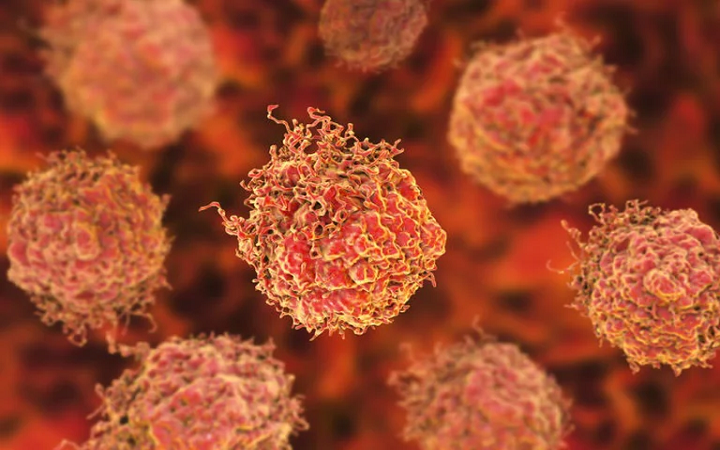 Bacterias de la orina pronosticarían el riesgo de cáncer de próstata agresivo