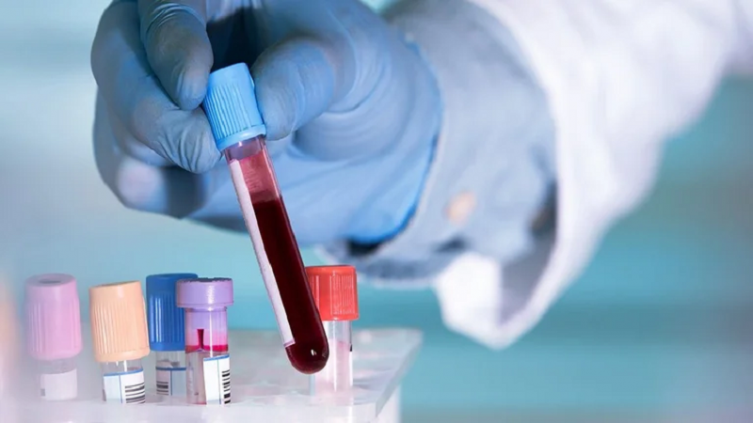 Qué es la vasculitis, la enfermedad que padeció Ashton Kutcher 