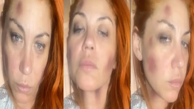 Lourdes Fernández, ex Bandana, denunció que su expareja la golpeó brutalmente 