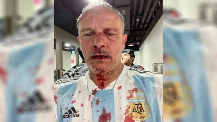 Lusail: Mexicanos agredieron salvajemente a un argentino y su hijo