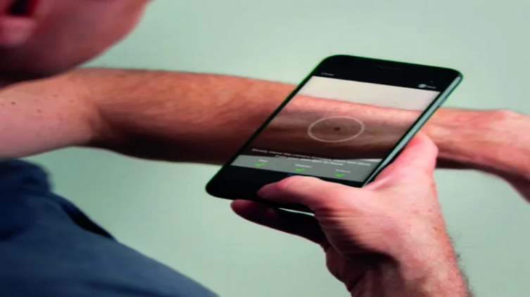 Tecnología y salud: app detecta casos de cáncer de piel