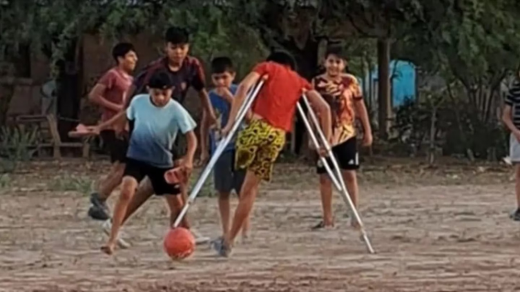 Un niño sin una pierna la rompe jugando al fútbol en muletas