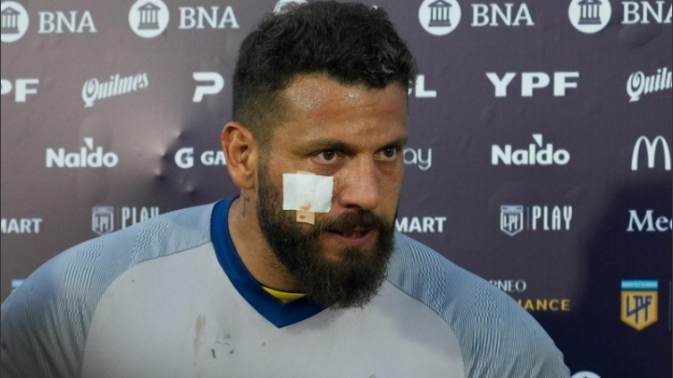 Broun sobre los incidentes en el clásico