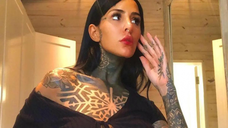 Cande Tinelli usa un tratamiento de belleza que utiliza su sangre