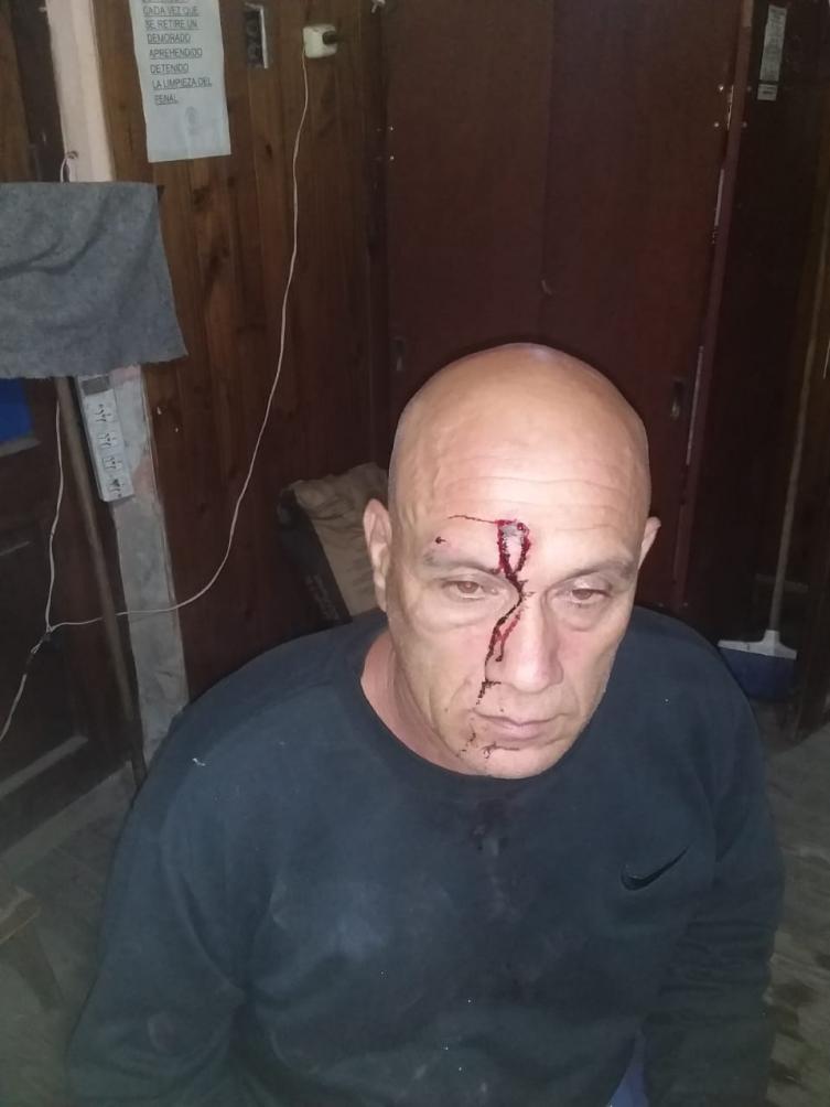 Un taxista recibió un piedrazo a la altura del puente sobre el río Salado