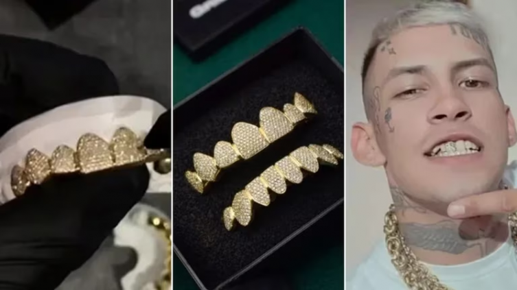 L-Gante tiene dentadura con detalles de oro e incrustaciones de diamante