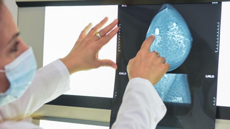 Salud recuerda las señales de alerta y controles de prevención en el día mundial del cáncer de mama
