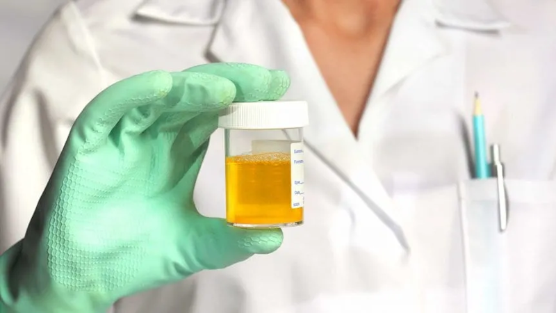 44 deportistas castigos por doping en Kenia