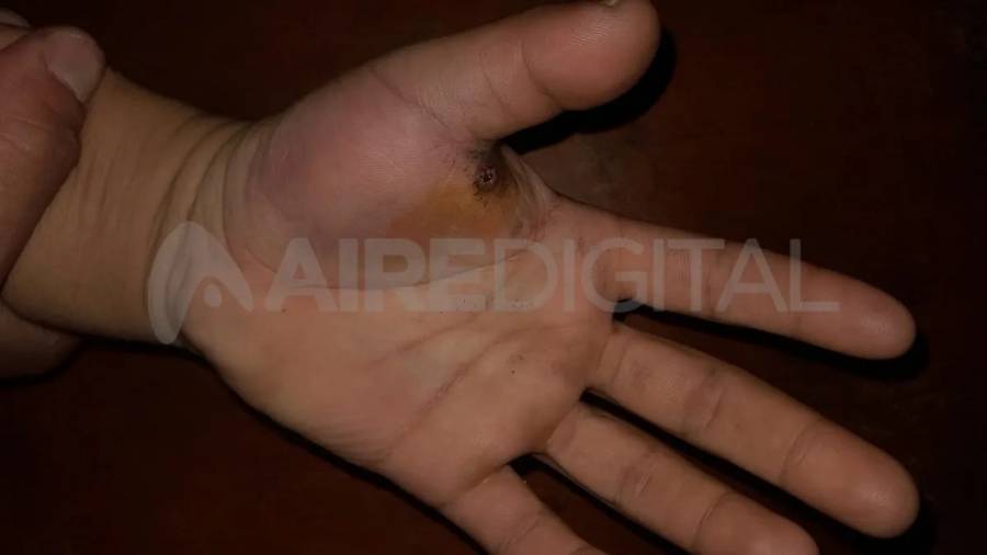 Le quisieron robar la moto, se resistió y le pegaron un tiro en la mano