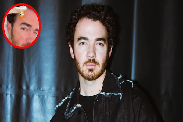 Kevin Jonas, integrante de los Jonas Brothers, reveló que padece cáncer de piel