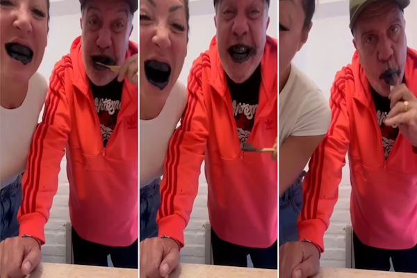 Divertidos: Coco Sily y su novia blanqueándose los dientes