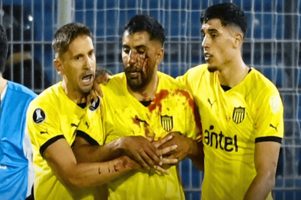 Rosario Central: condenan al hincha que apedreó a un jugador de Peñarol