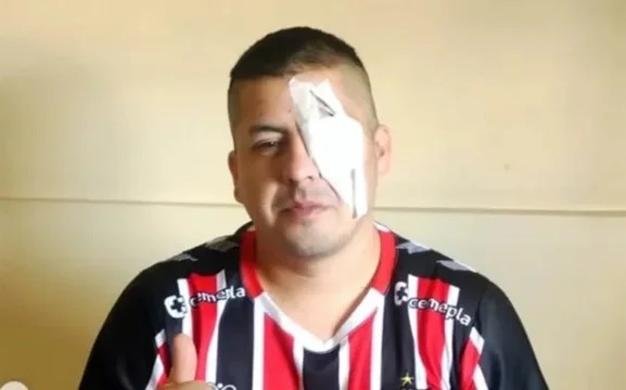 Un hincha de Chacarita denunció a Patricia Bullrich tras perder un ojo por la represión en el Congreso
