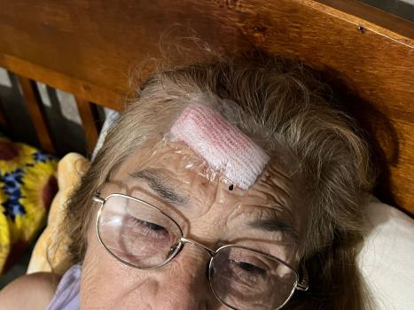 Una pareja de 70 años resultó herida en un robo callejero
