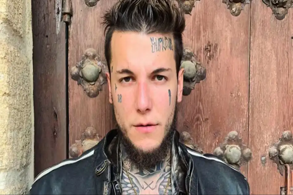 Alex Caniggia sorprendió al borrarse los tatuajes de la cara