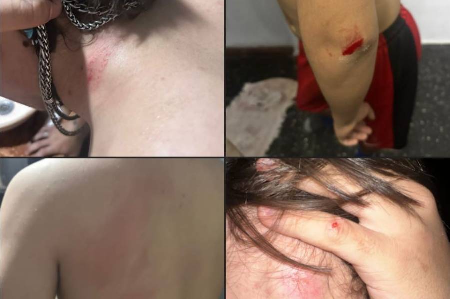 Amenazó y golpeó a un niño de 15 años tras una pelea de perros