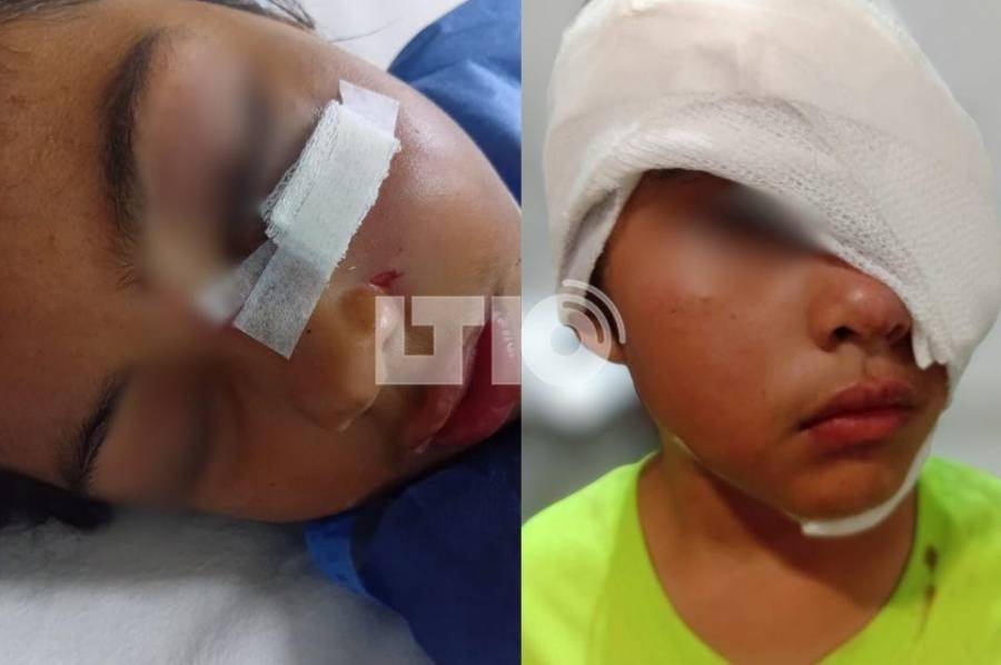 Una niña de 8 años fue mordida en el rostro por un Pitbull