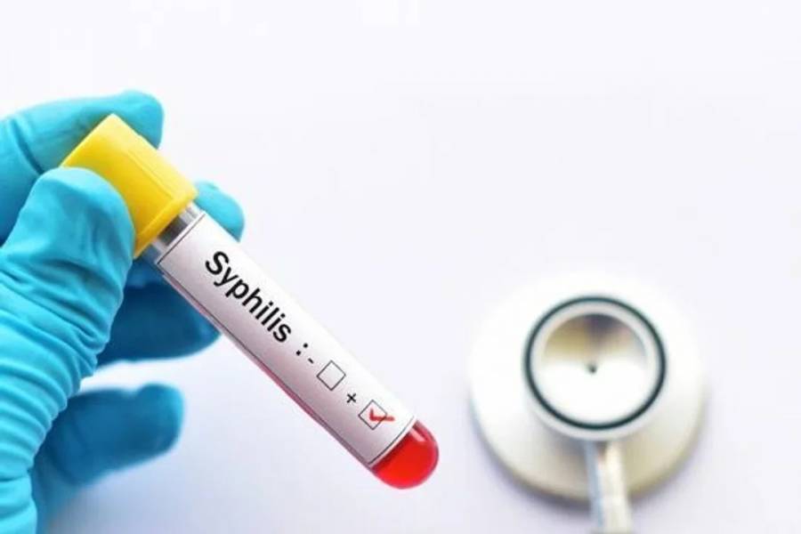 En Argentina se registraron más de 50 mil casos de sífilis