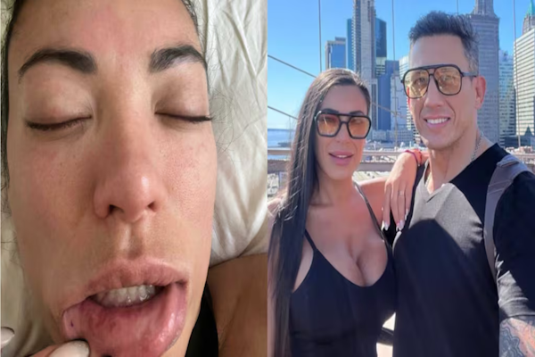 Las fotos que Pamela Pombo presentó en la causa contra su exmarido